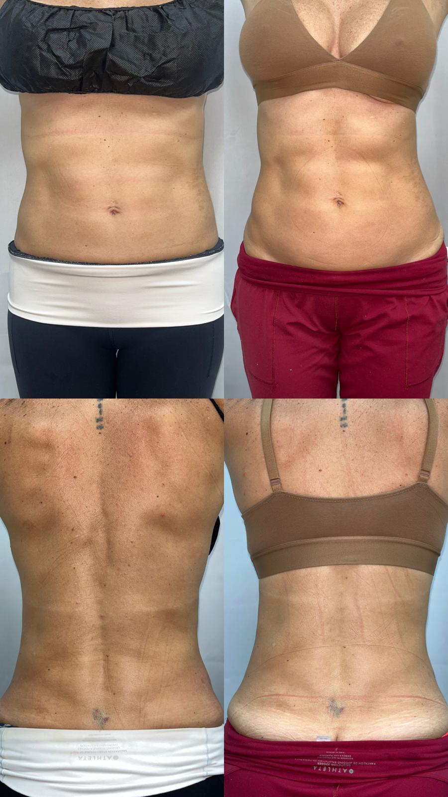Before / After