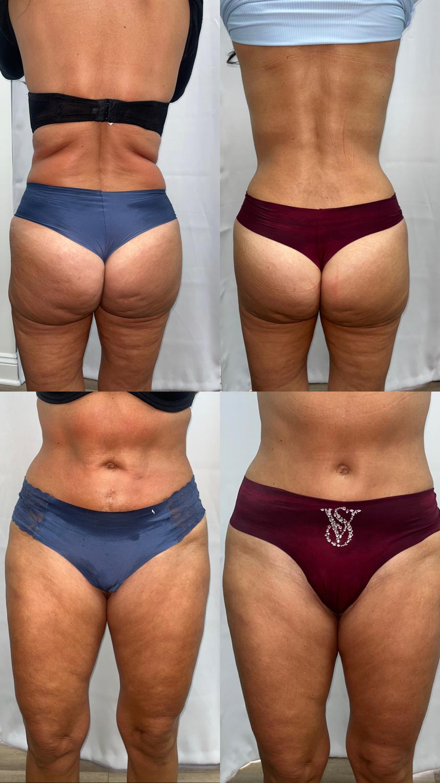 Before / After