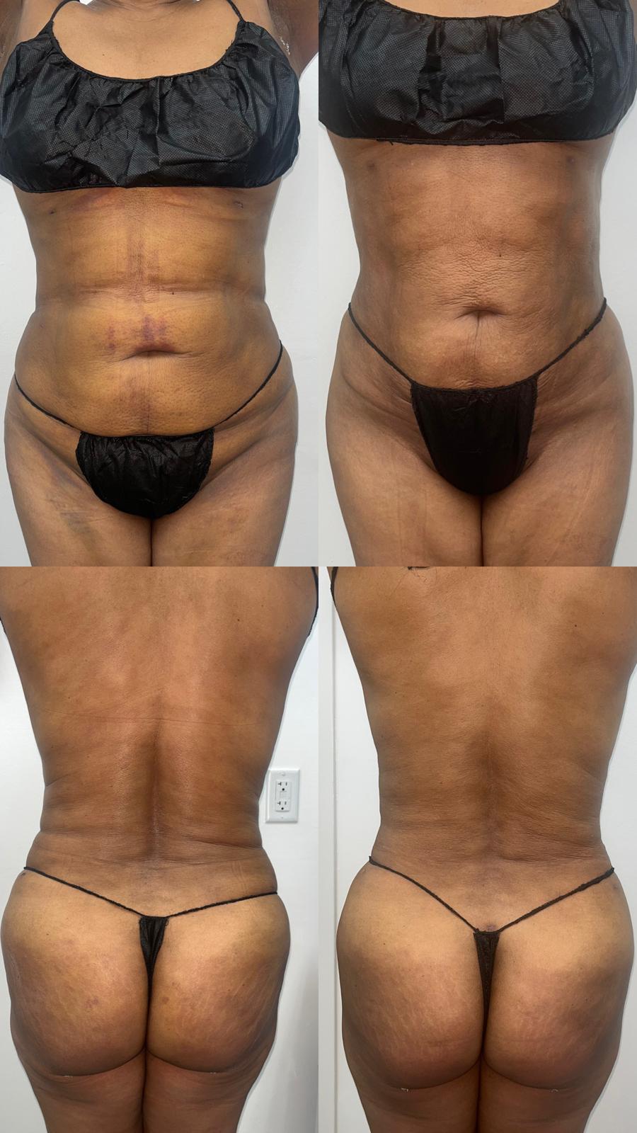 Before / After